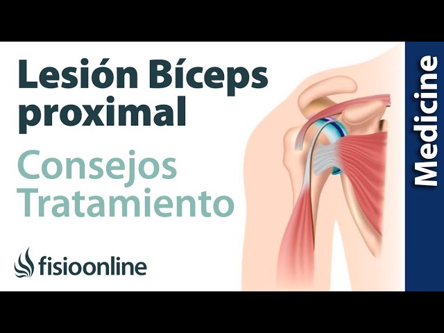 rotura del tendón del bíceps