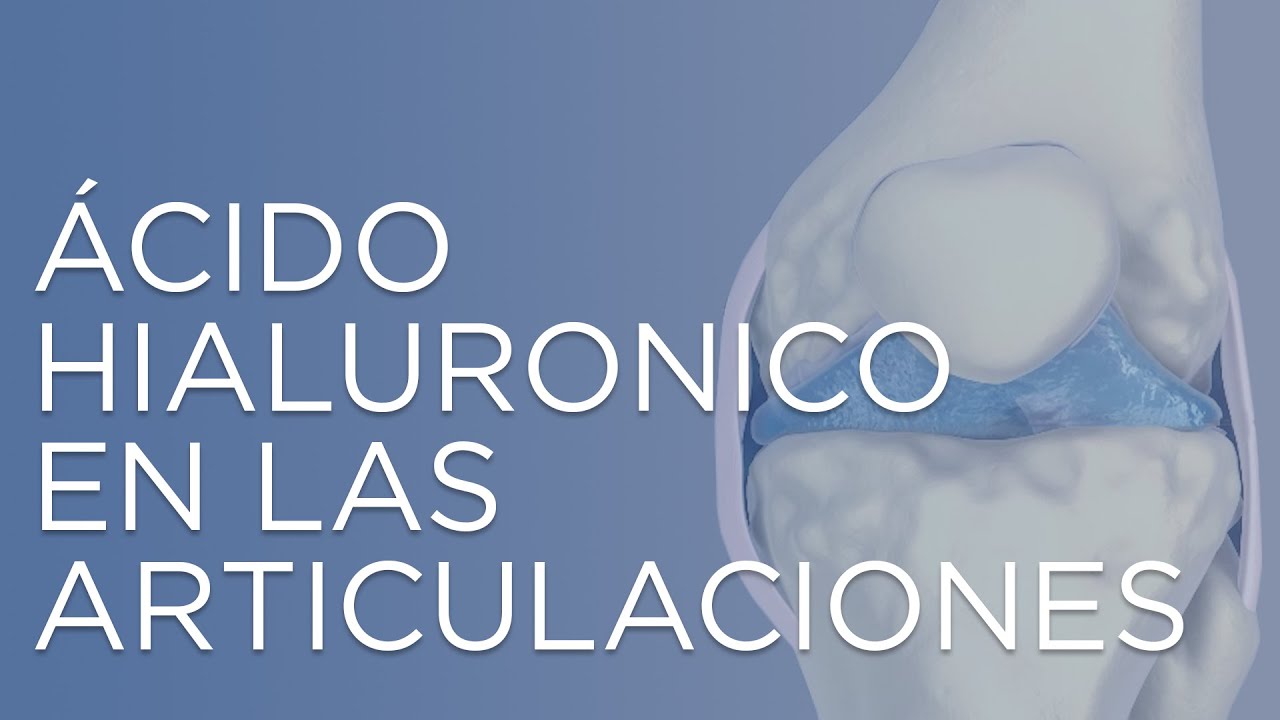 cuanto tarda en hacer efecto una infiltración de ácido hialurónico