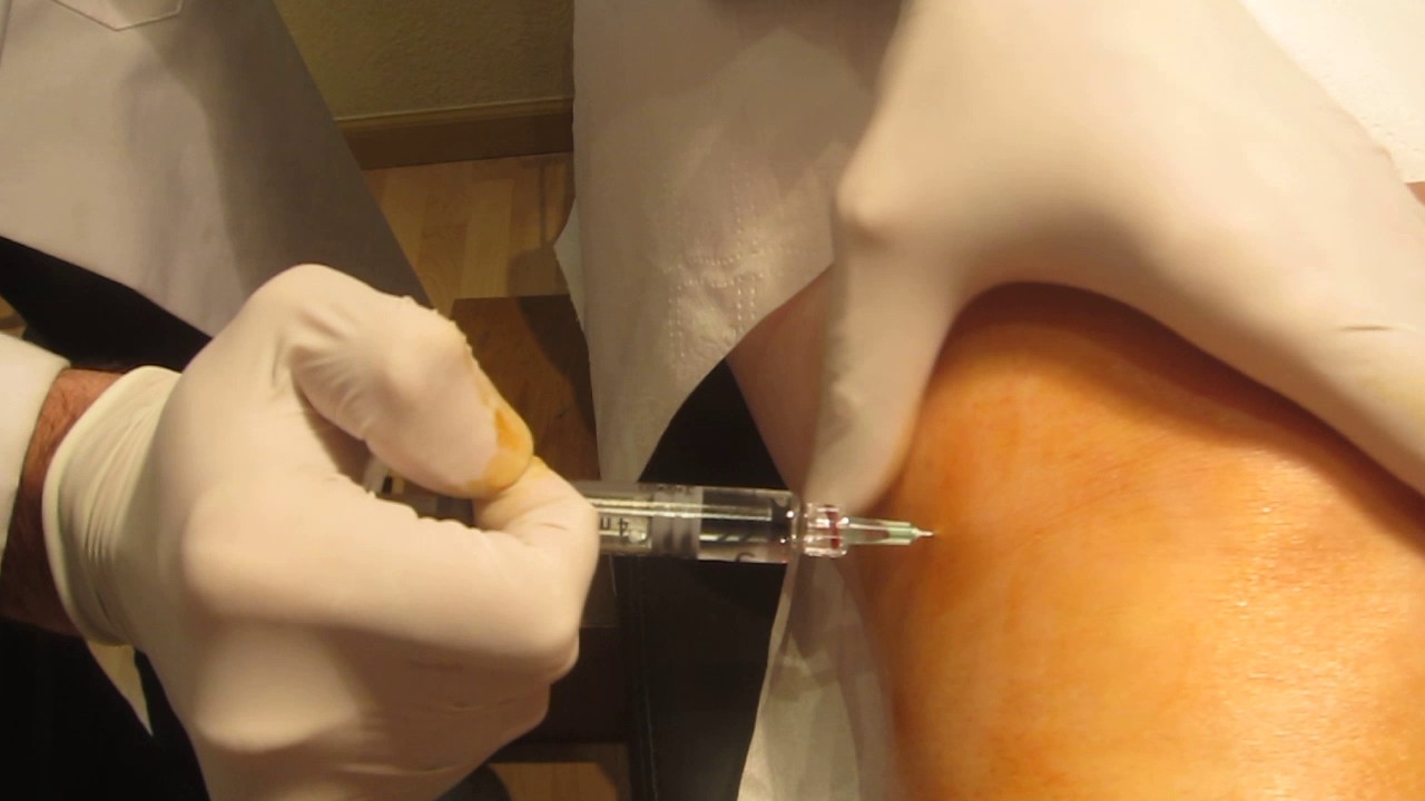 cuidados después de una infiltración de rodilla con ácido hialurónico