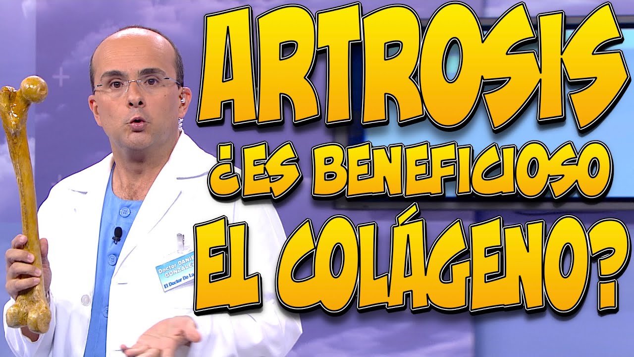 el colageno sirve para la artrosis