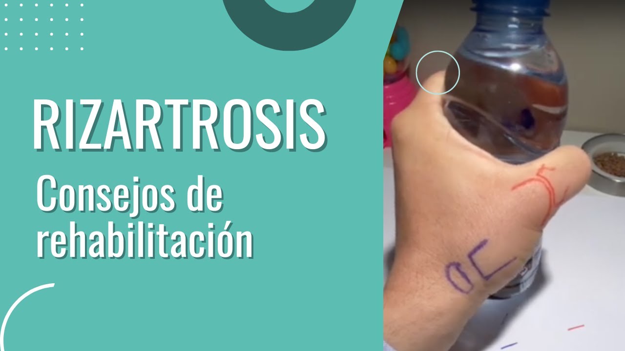 rehabilitacion despues de operacion rizartrosis pulgar