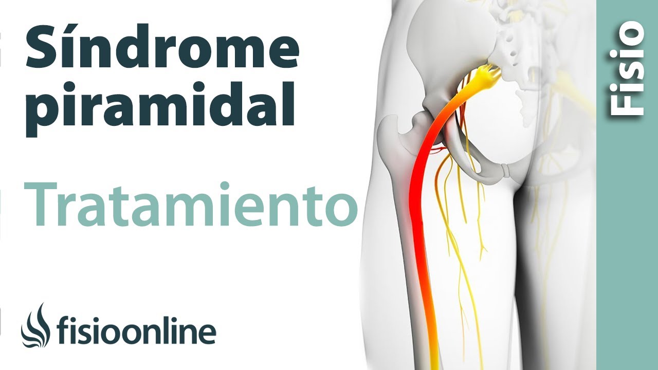 como se cura el sindrome piriforme