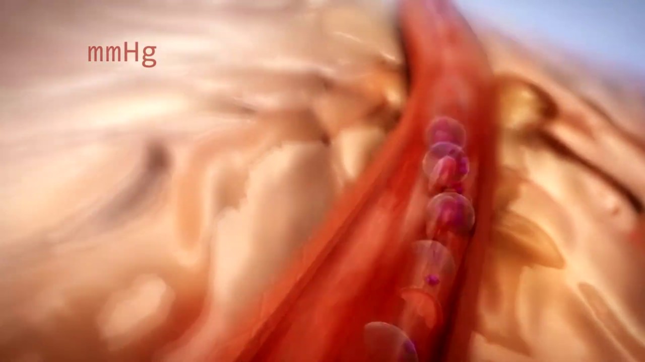 diferencia entre tension y presion arterial