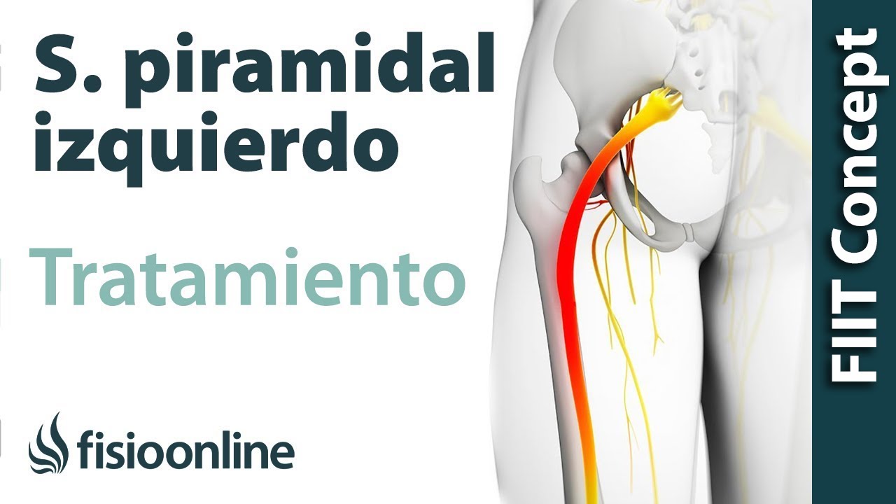 dolor del gluteo hasta la rodilla