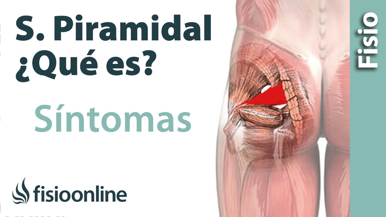 dolor en el gluteo que baja por la pierna