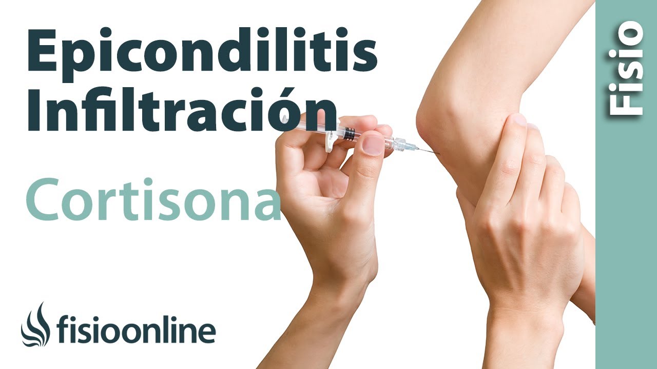 duelen las infiltraciones en el codo