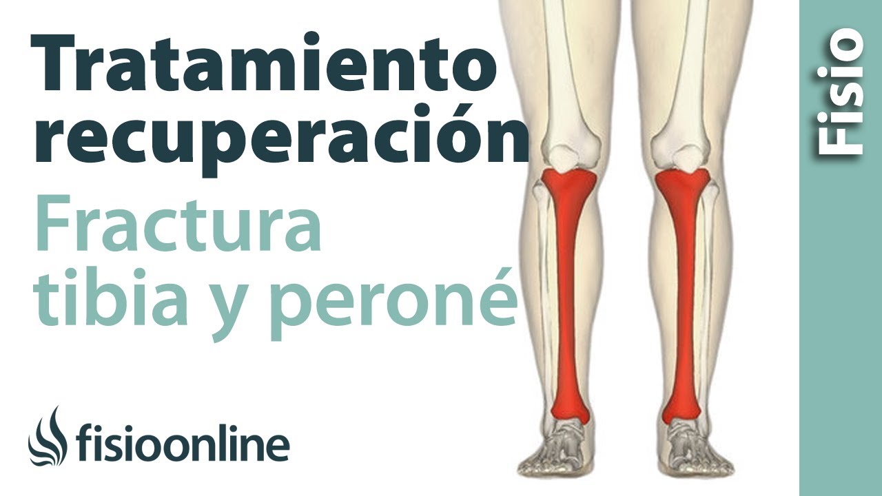 imágenes de la tibia y el peroné