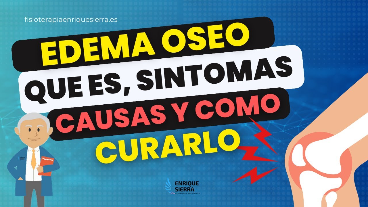 que es un edema oseo en la rodilla