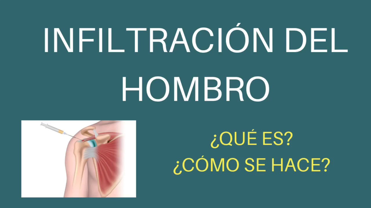 que es una infiltración en el hombro