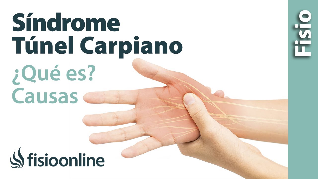 quien trata el sindrome del tunel carpiano