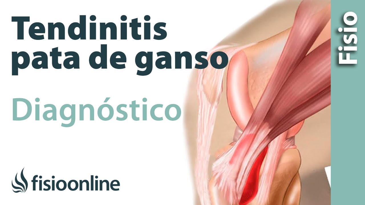 tendón pata de ganso para ligamento cruzado anterior