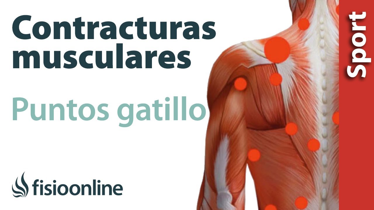 tipos de contracturas en la espalda